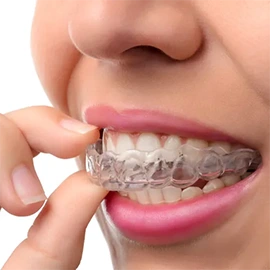 Veneers Lakewood CA dentist